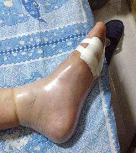 论TT的正确用法。 论TT的正确用法。